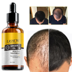 lichen-ginger-anti-hair-loss-hair-serum-30ml