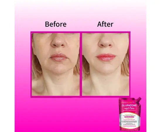 GLUPATONE Emulsion 50ml And 2 Pcs Homeo Cure Beauty Cream - Gift Point
