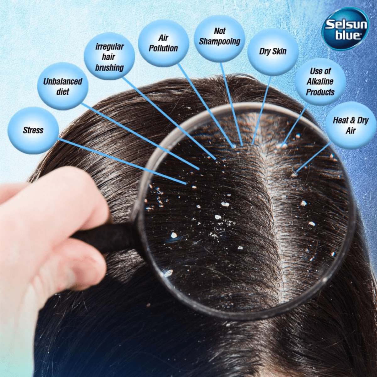 Selsun Blue Normal To Oily Anti-Dandruff Shampoo 250ml - Gift Point